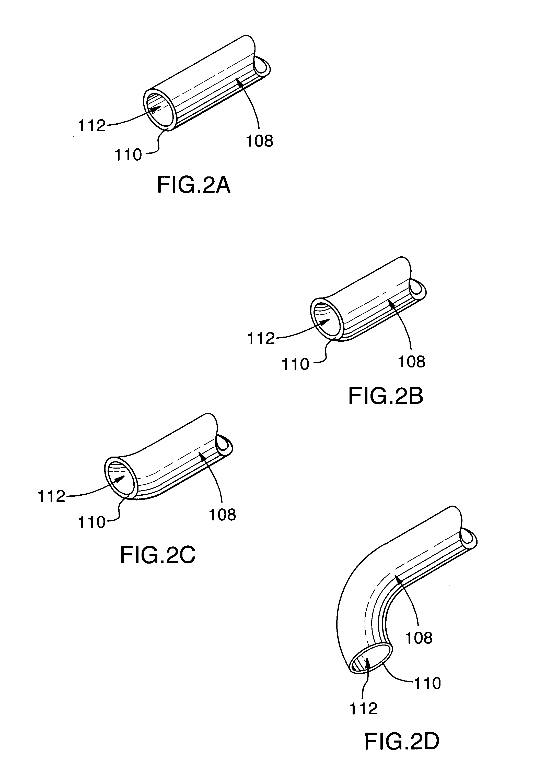 Method for removing material from a patient's body