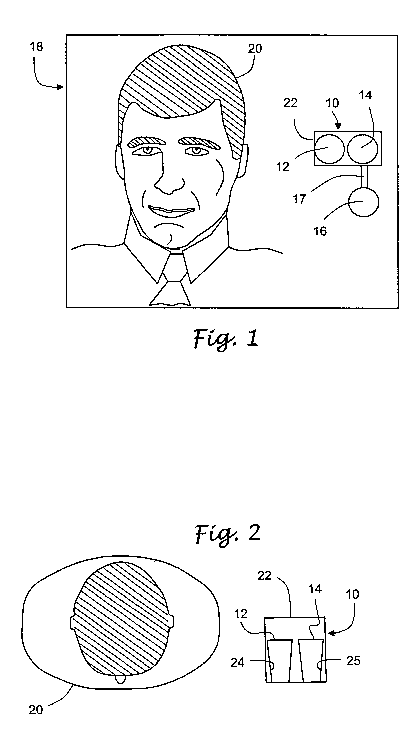 Methods and apparatus for a remote, noninvasive technique to detect core body temperature in a subject via thermal imaging