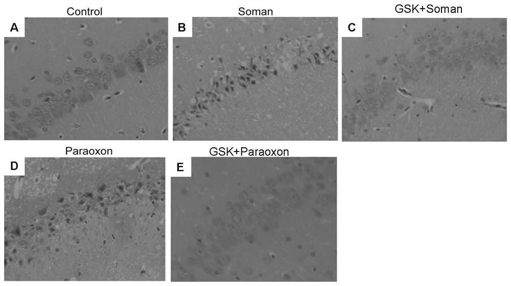 Trpv4 ion channel as a drug target in organophosphorus compound poisoning