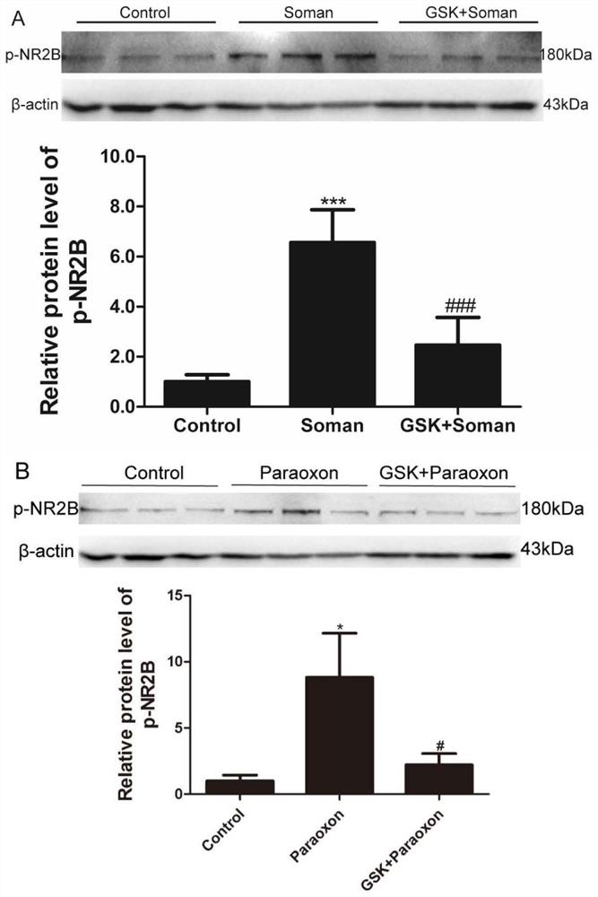 Trpv4 ion channel as a drug target in organophosphorus compound poisoning