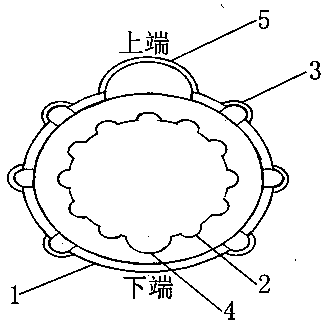 Inclined circular foreskin resistance complex ring