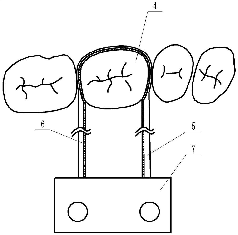 A dental crown preparation device