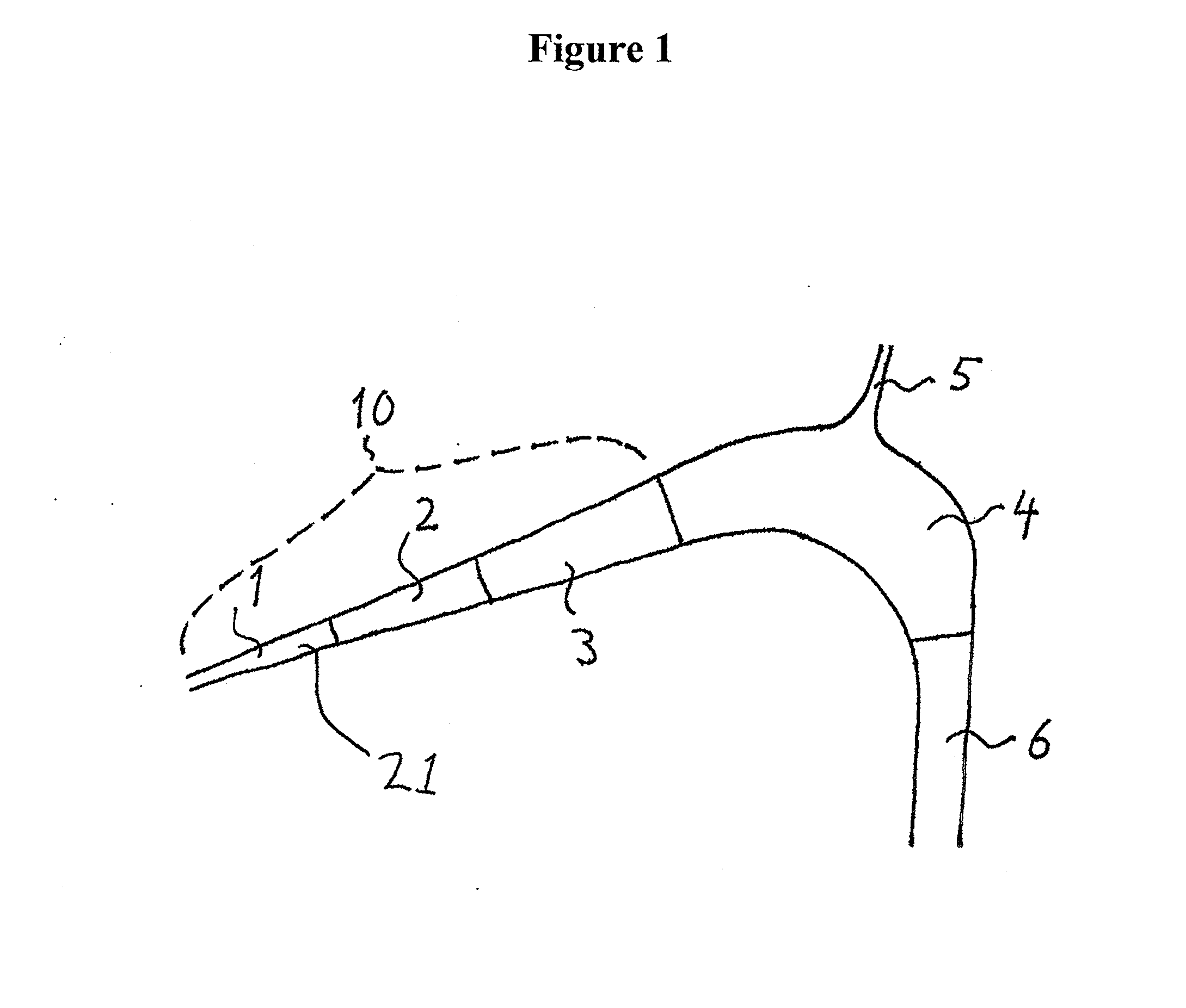 Bubble reducer for eliminating gas bubbles from a flow
