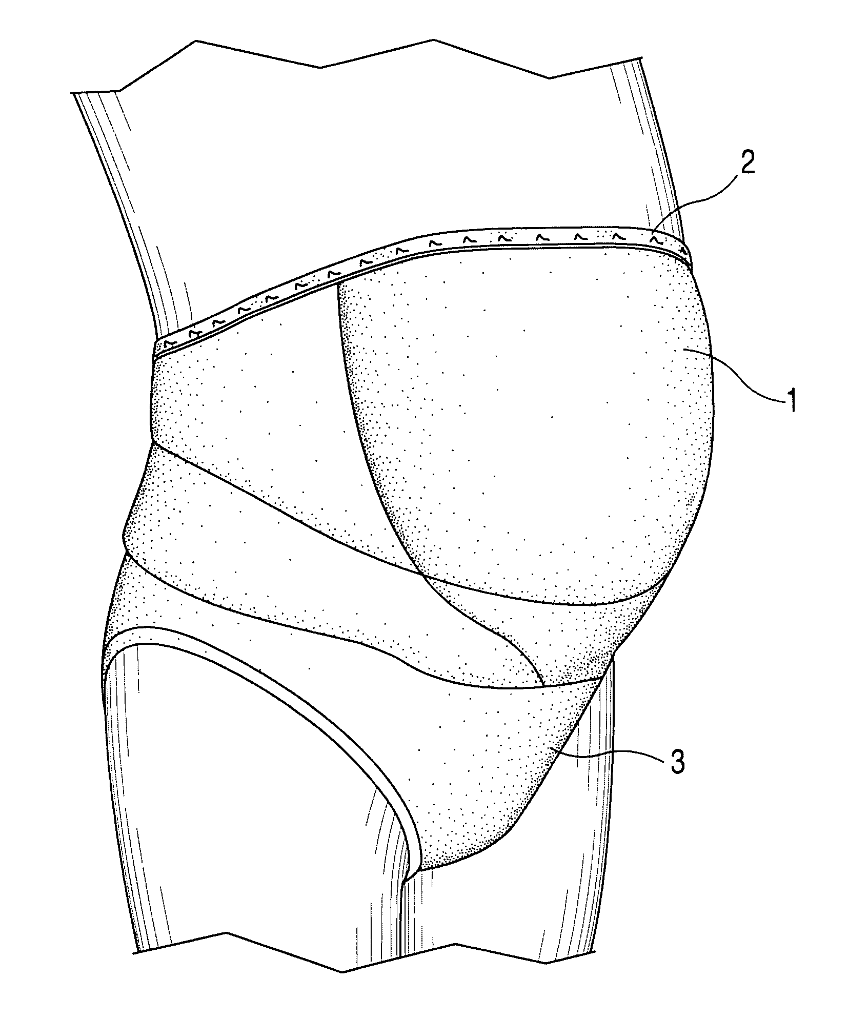 Abdominal support garment with post-surgical incision protection