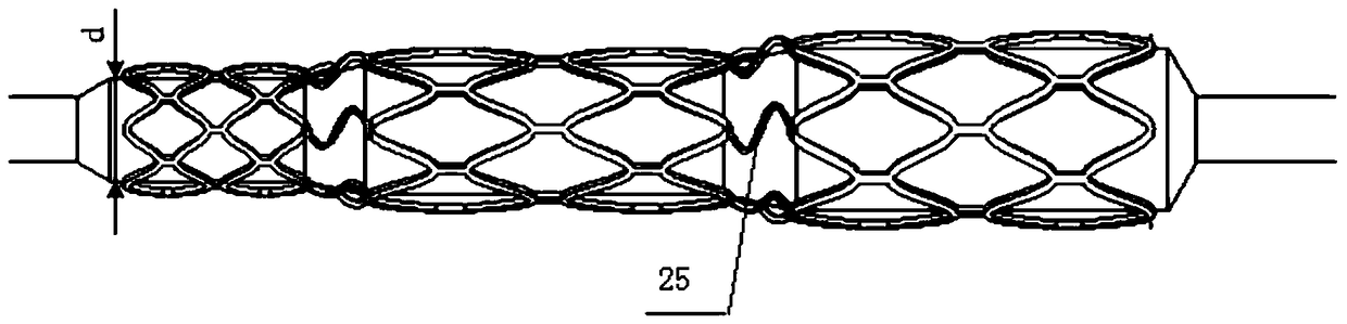 A step-shaped balloon-expandable vascular stent