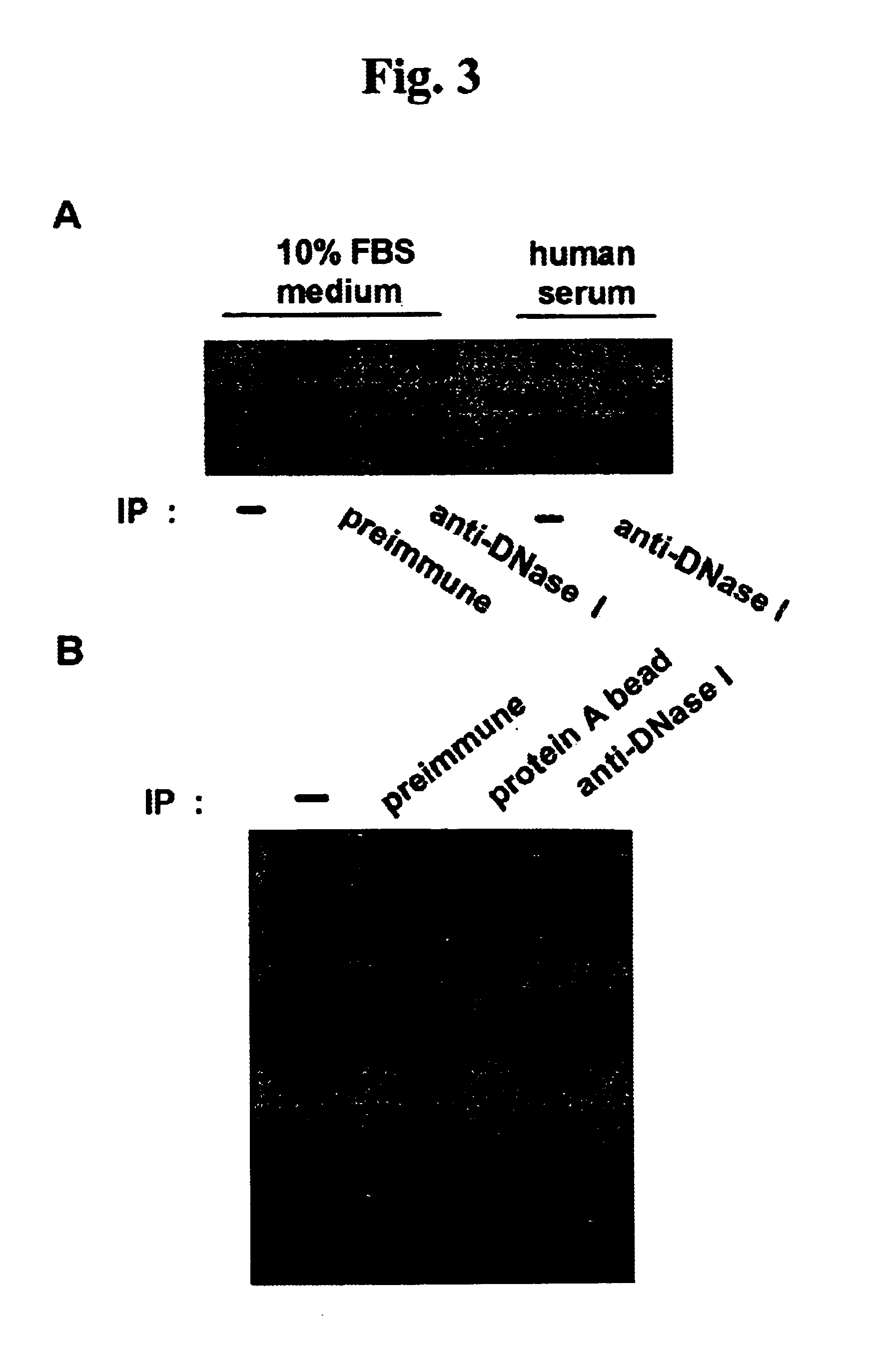 Endonuclease of immune cell, process for producing the same and immune adjuvant using the same