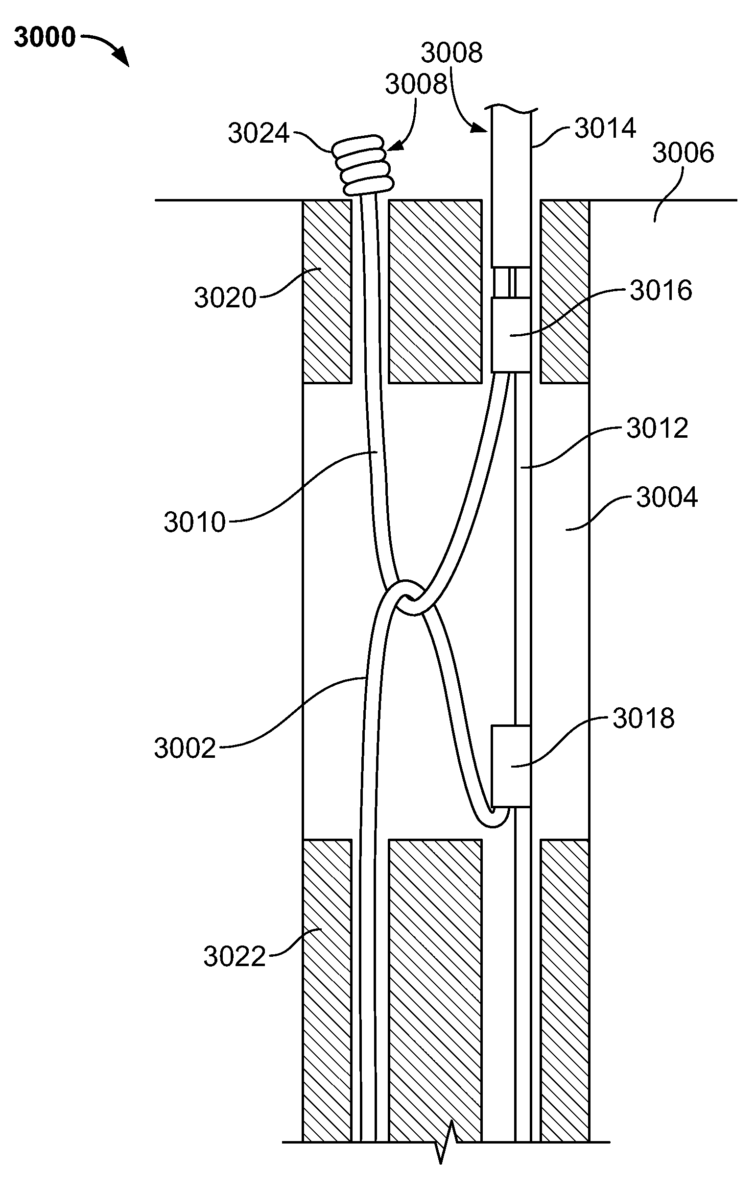 Tissue ligation devices and controls therefor