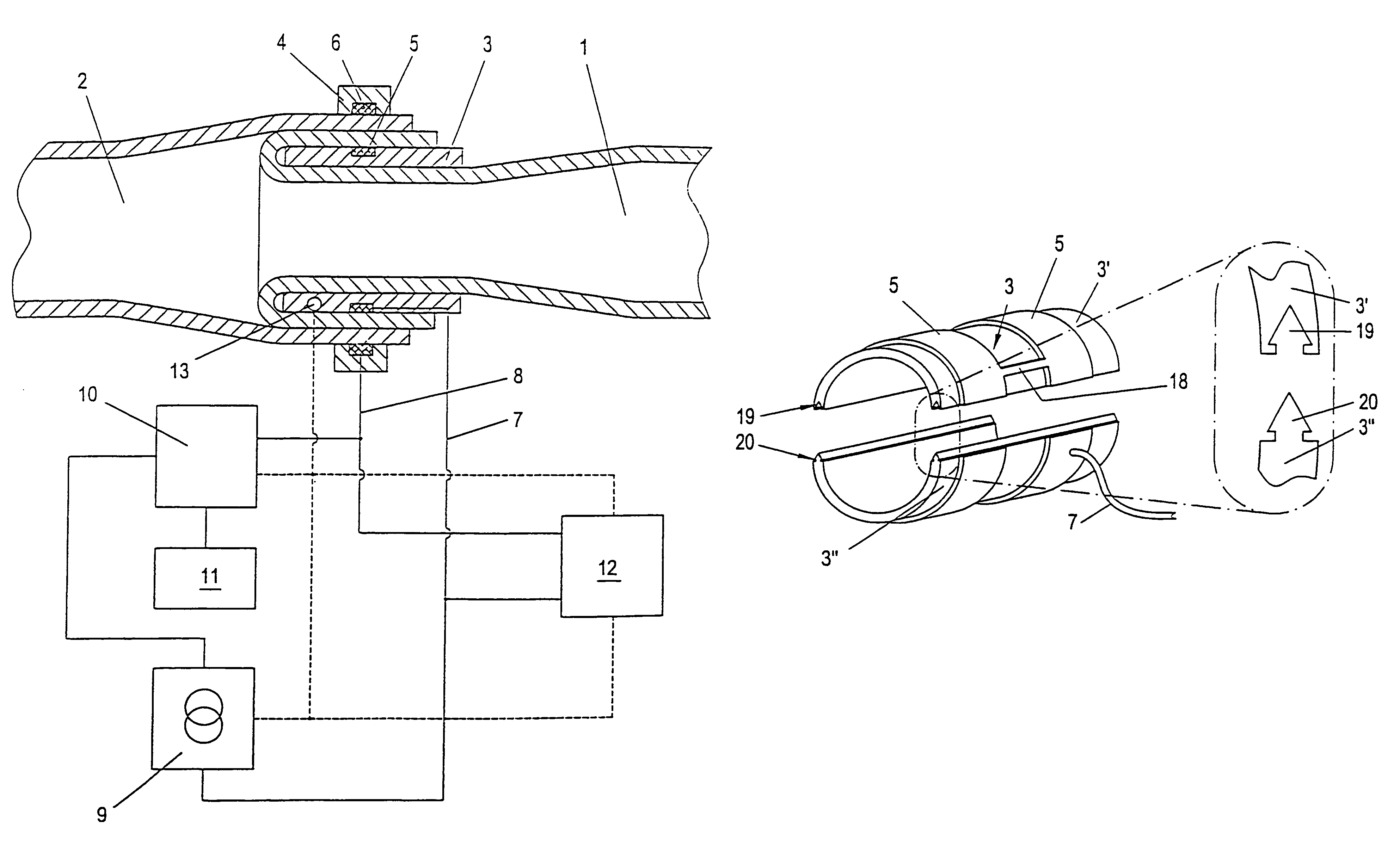 Device for the production of anastomoses between hollow organs