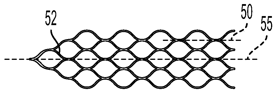 Devices and methods for treating blocked blood vessels