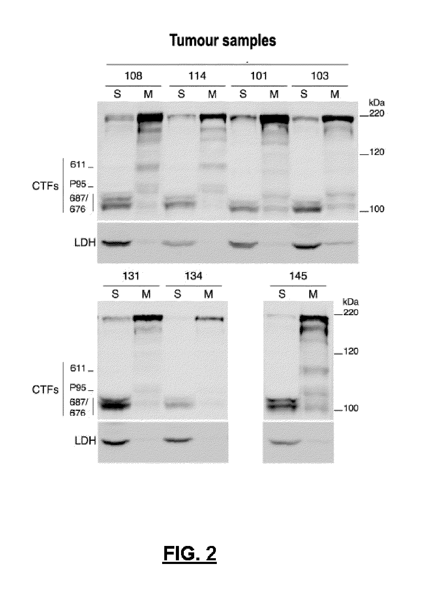 Antibodies Against HER2 Truncated Variant CTF-611