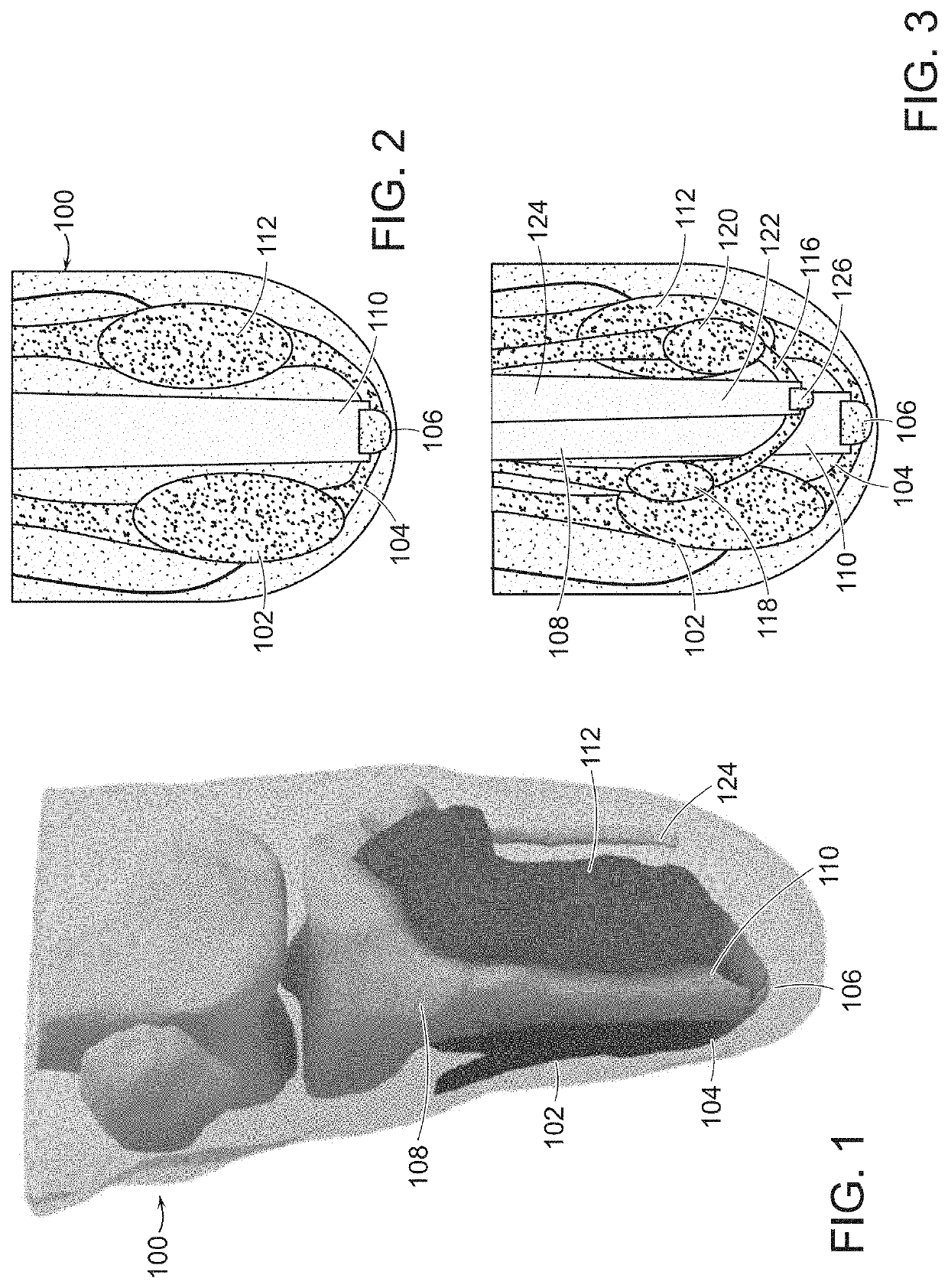 Method And System For Providing Proprioceptive Feedback And Functionality Mitigating Limb Pathology