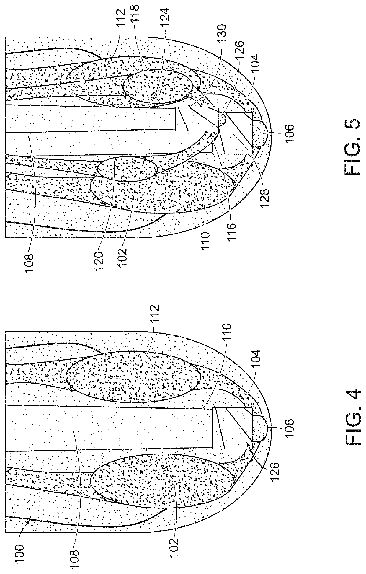 Method And System For Providing Proprioceptive Feedback And Functionality Mitigating Limb Pathology