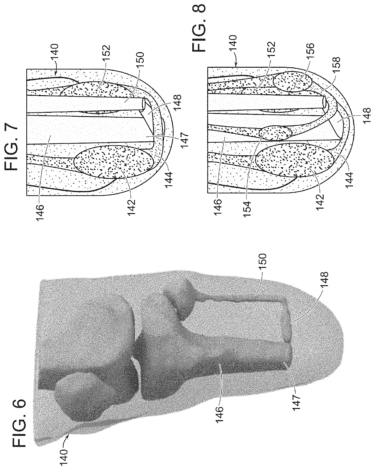 Method And System For Providing Proprioceptive Feedback And Functionality Mitigating Limb Pathology