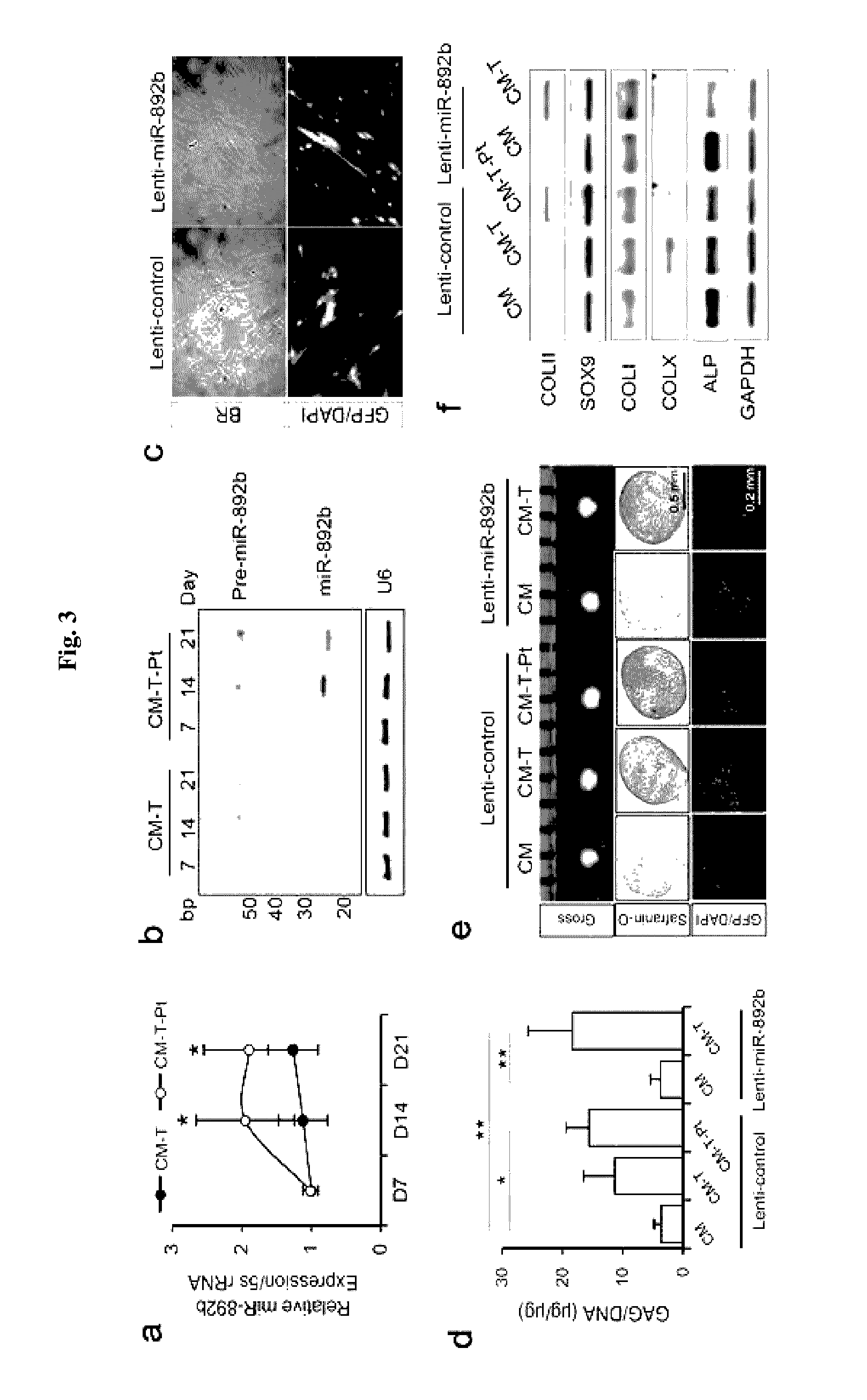 Composition for promoting chondrocyte differentiation or treating cartilage diseases, containing KLF10 expression inhibitor, and method for promoting cartilage differentiation by using same