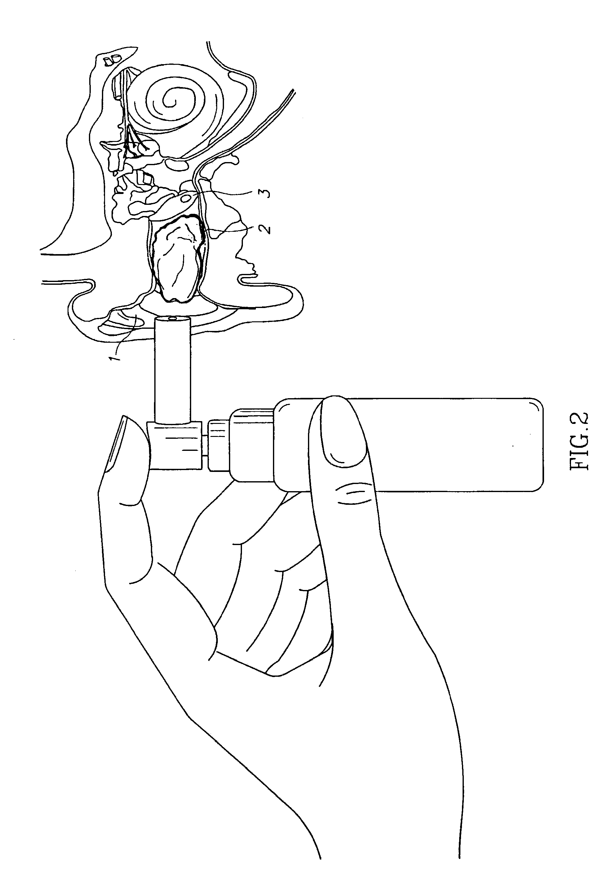 Compositions for treatment of ear disorders and methods of use thereof