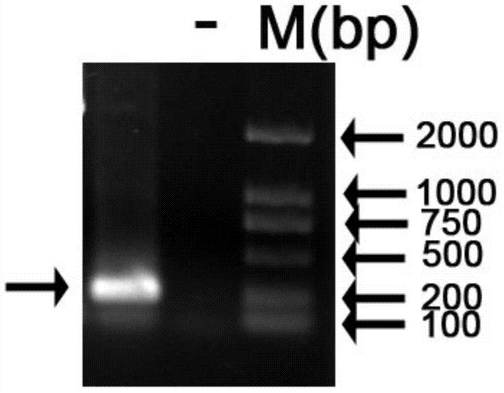 Soybean salt-tolerant gene GmCBL3 and application thereof