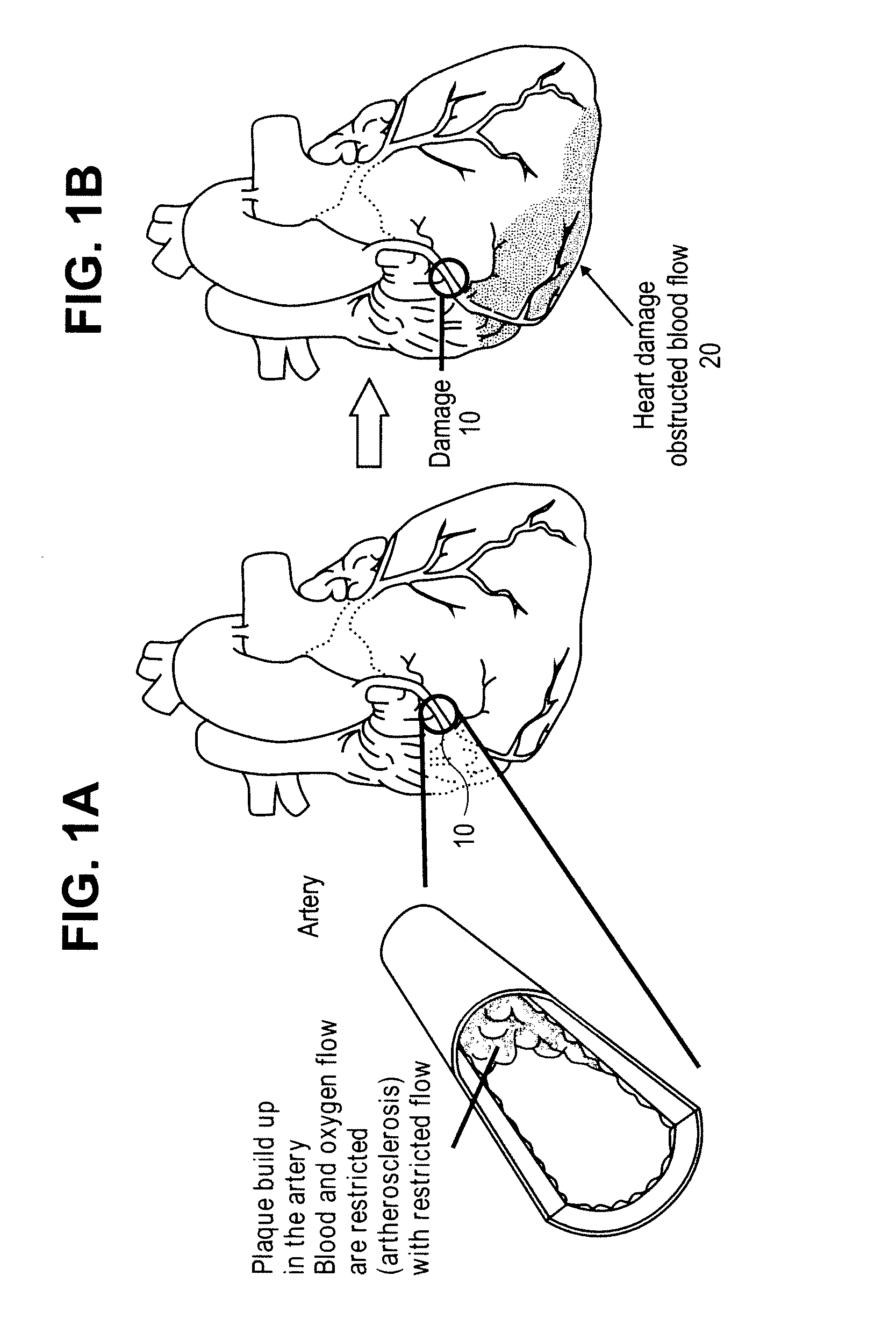 Methods and compositions for treating tissue using silk proteins