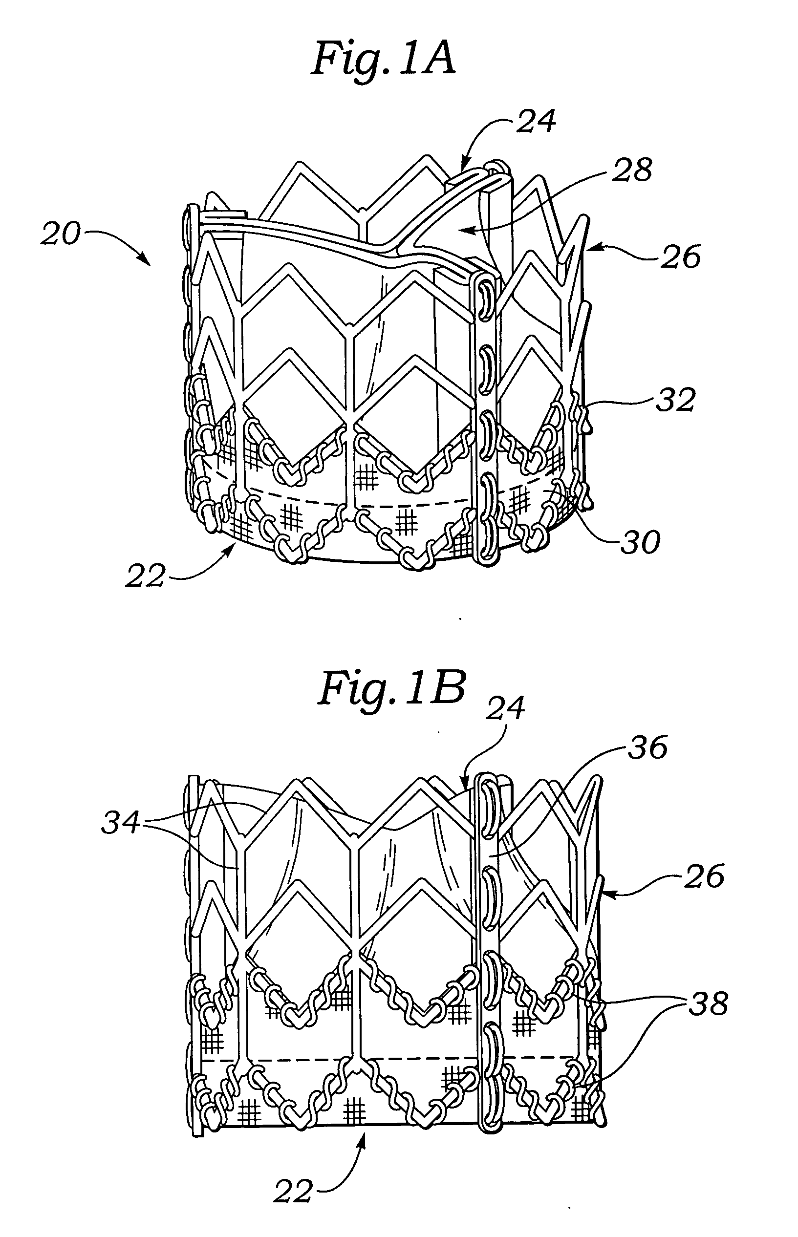System for deploying balloon-expandable heart valves