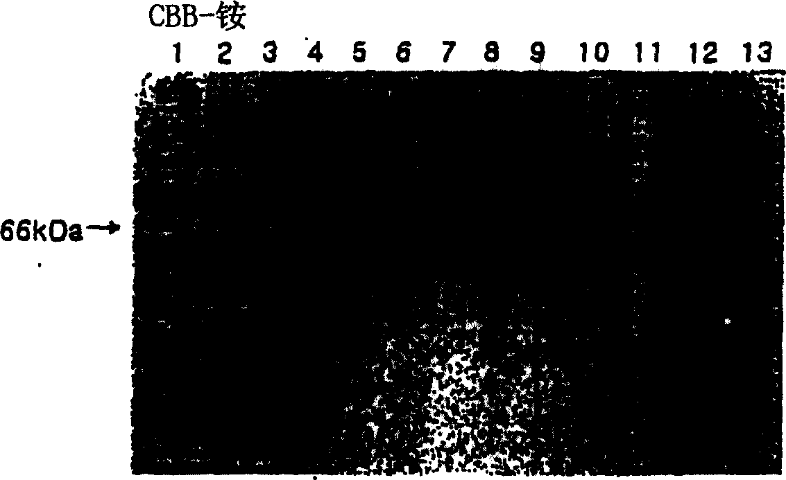 Treating solution containing aluminium ion for staining protein and staining method using the same