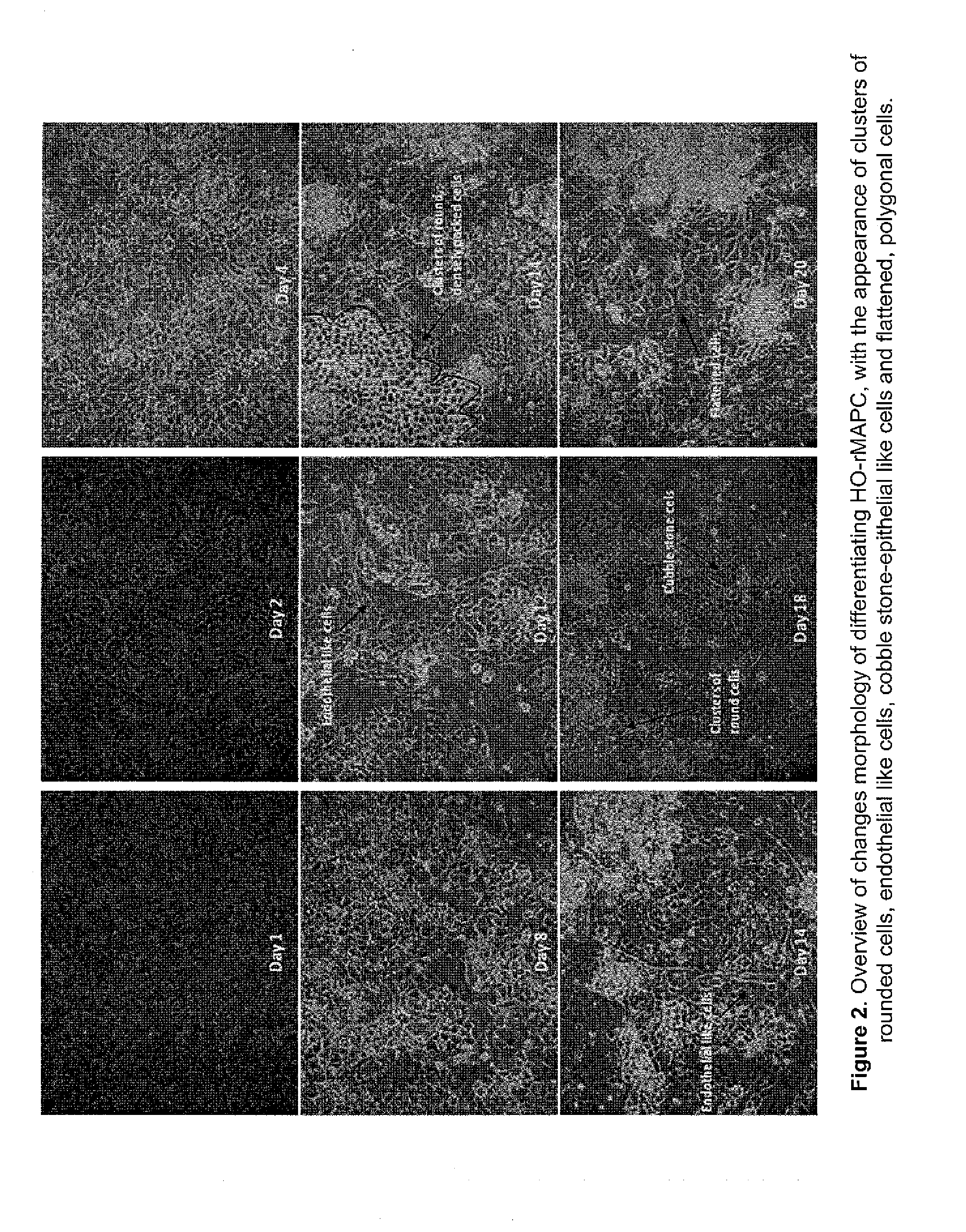 Optimized Methods for Differentiation of Cells into Cells With Hepatocyte and Hepatocyte Progenitor Phenotypes, Cells Produced by the Methods, and Methods of Using the Cells