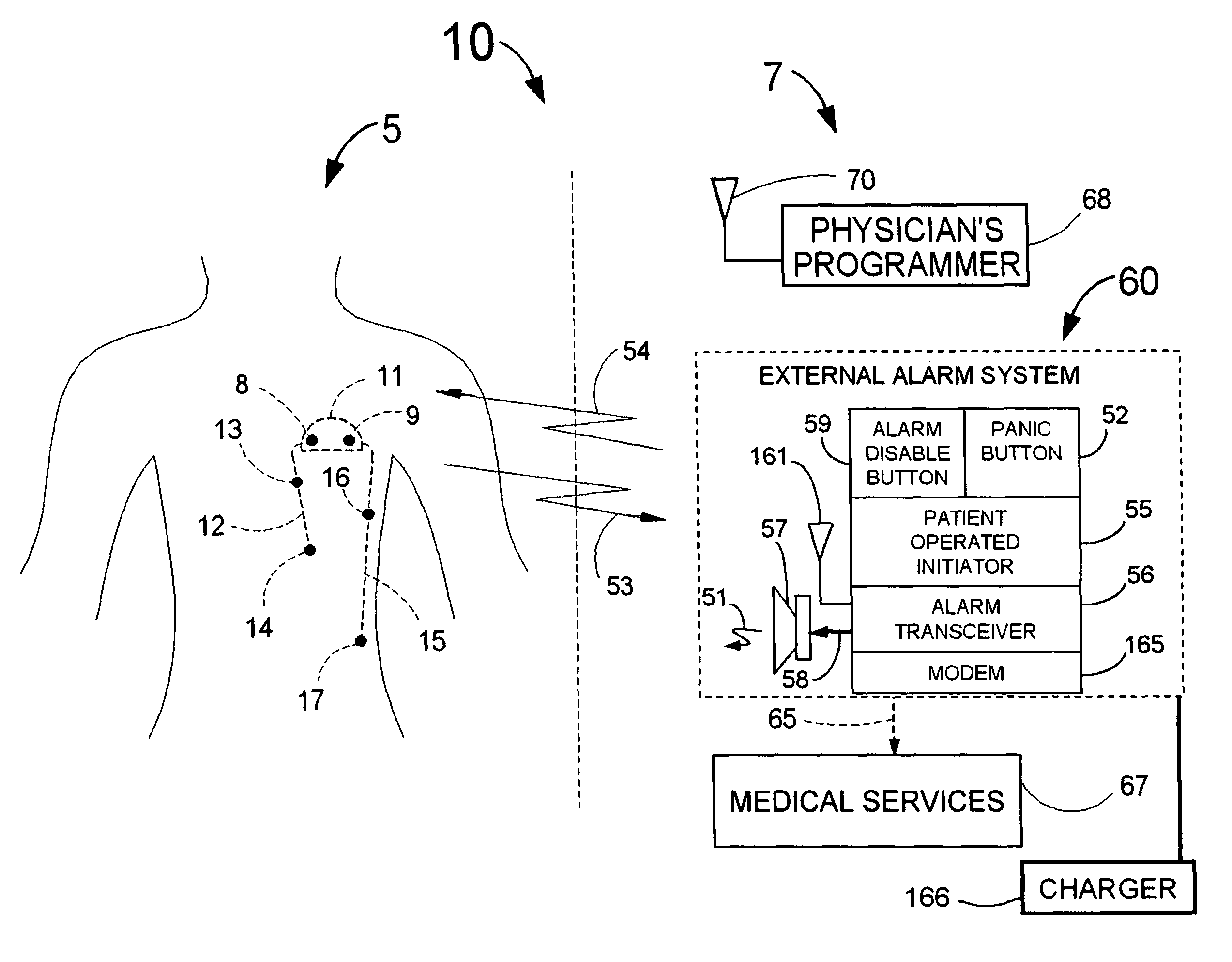 Cardiac event detection over varying time scale