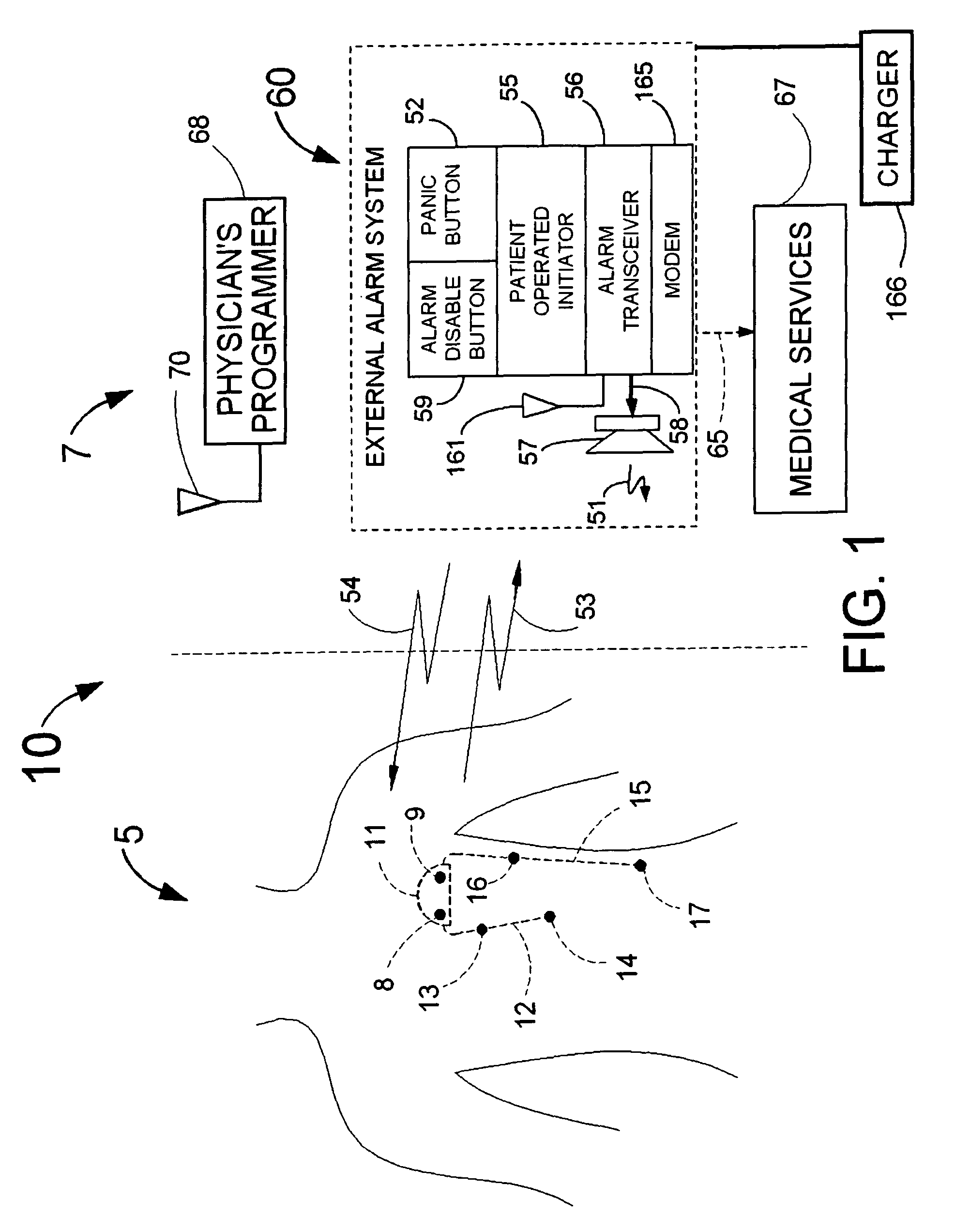 Cardiac event detection over varying time scale