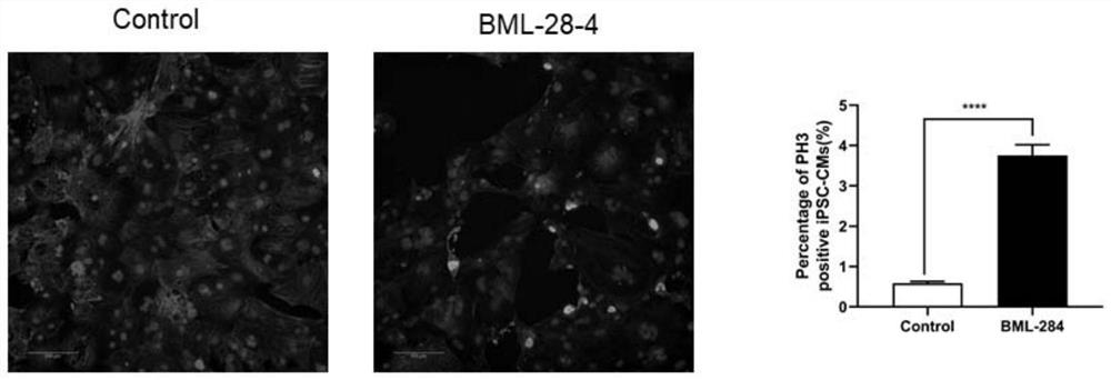 New drug use of bml-28-4