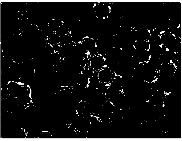 Inflammation-targeted neutrophile granulocyte medicine delivery system and application thereof