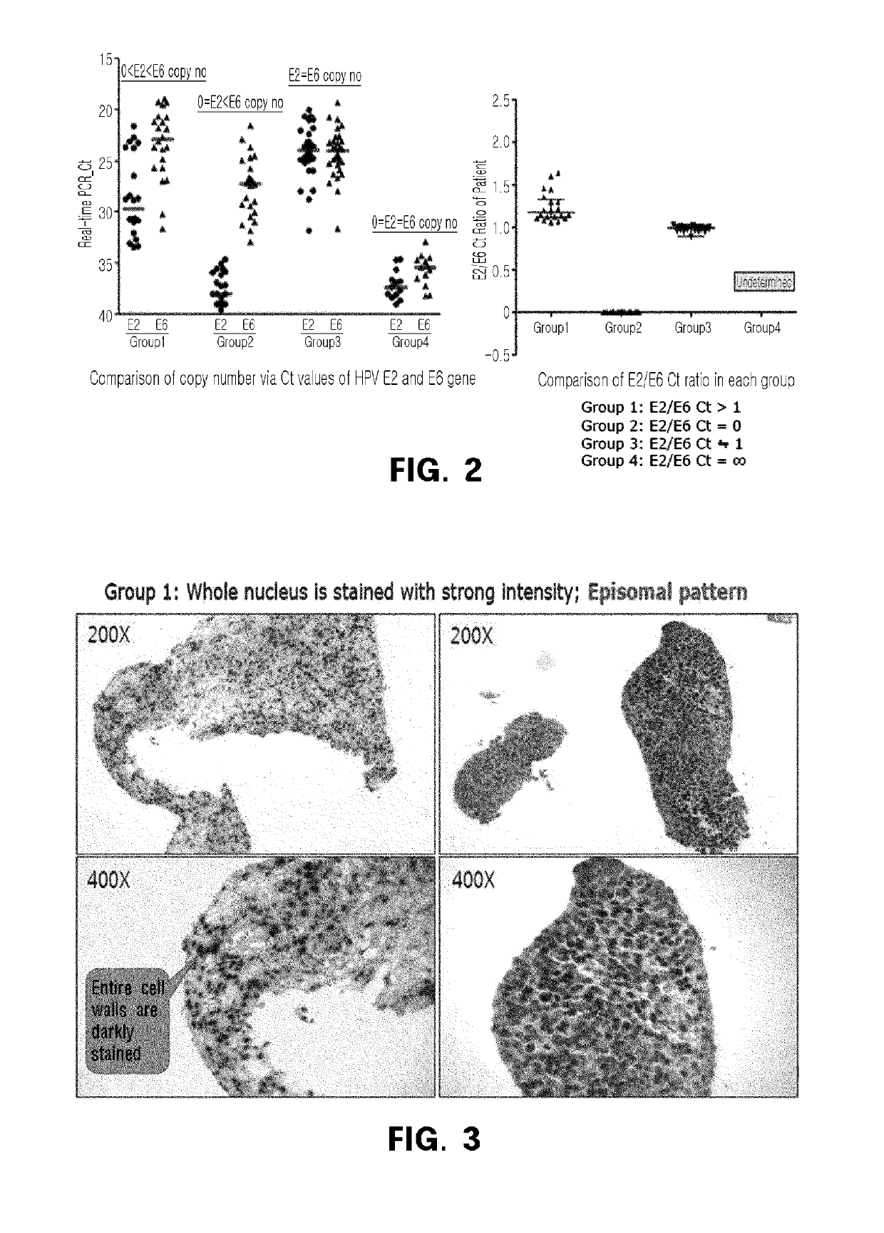 Method for prediction of prognosis by human papillomavirus DNA integration pattern