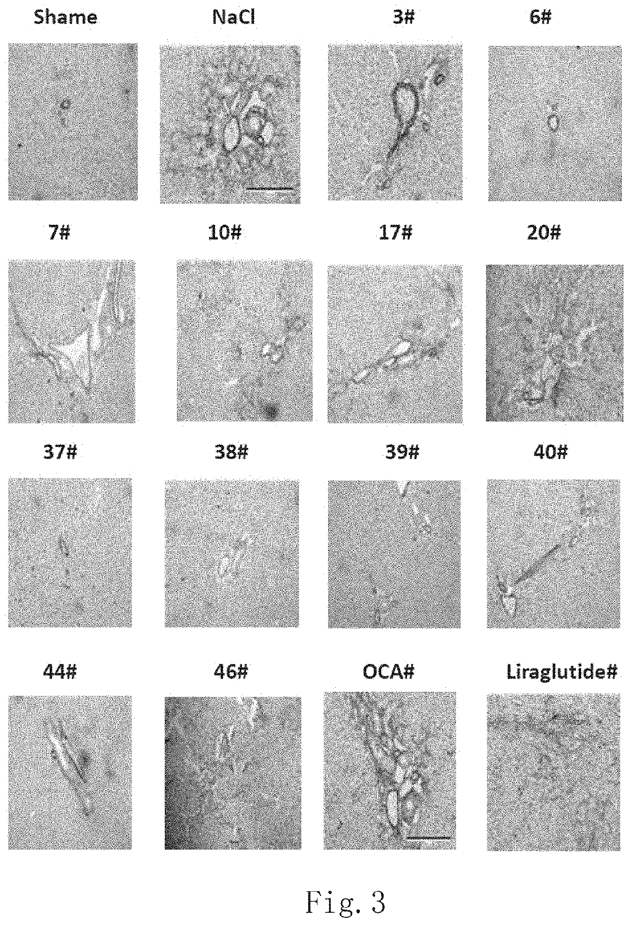 Treatment of biliary cirrhosis based on oxyntomodulin analogue glp-1r/gcgr dual-target agonist peptide