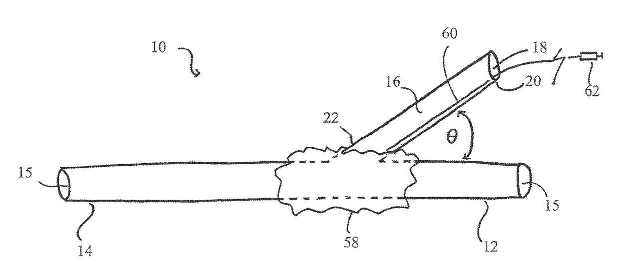 Systems, devices, and methods for organ retroperfusion along with regional mild hypothermia