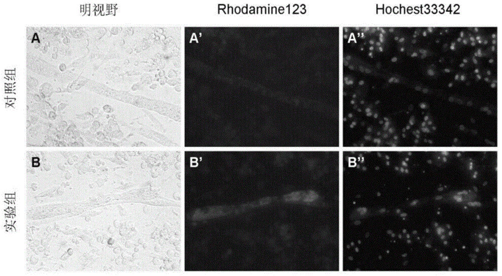 Culture method for improving oxidative metabolic capability of chicken skeletal muscle cells