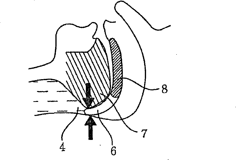 Apparatus for preventing snoring and method using same