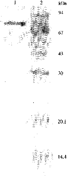 Method for separating and purifying immunoglobulin A, immunoglobulin G and lactoferrin from bovine colostrum in industrializing way
