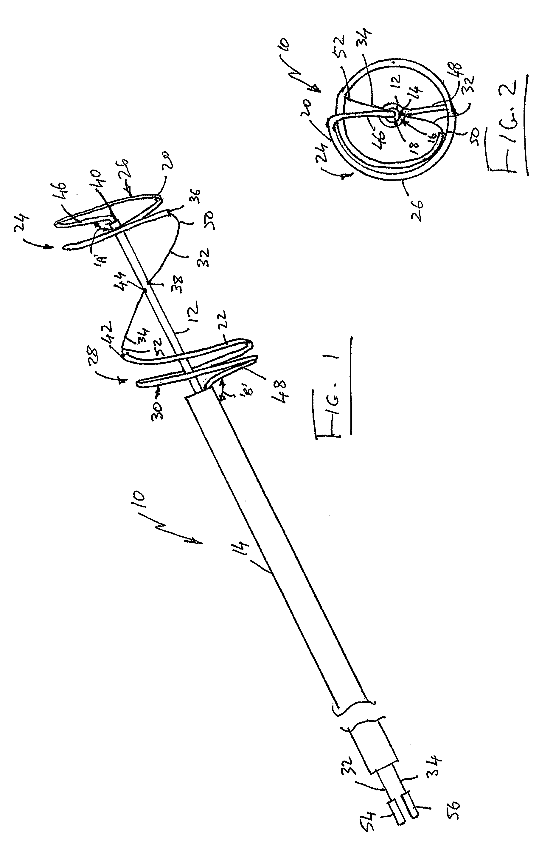 Catheter Assembly With an Adjustable Loop