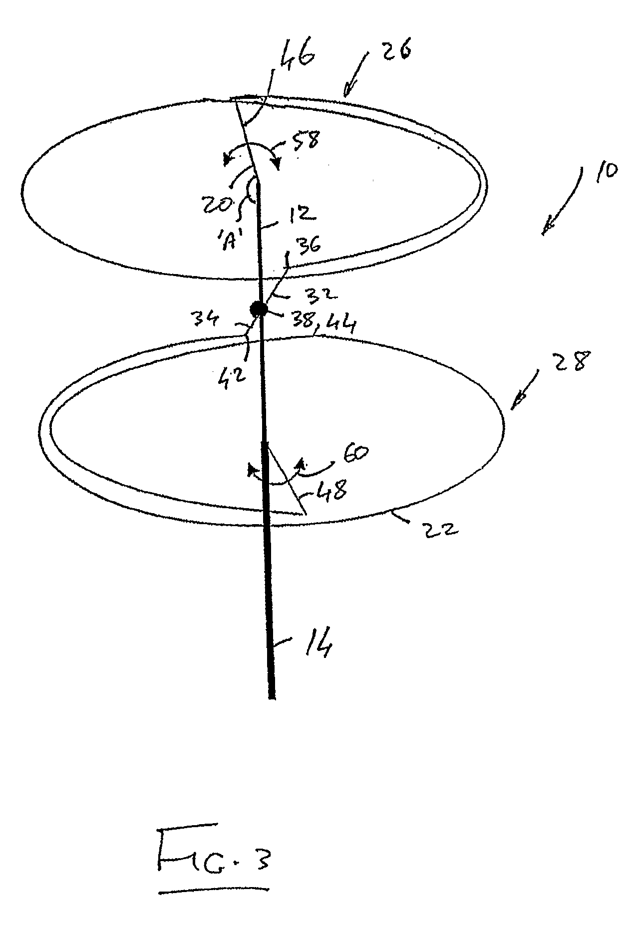 Catheter Assembly With an Adjustable Loop