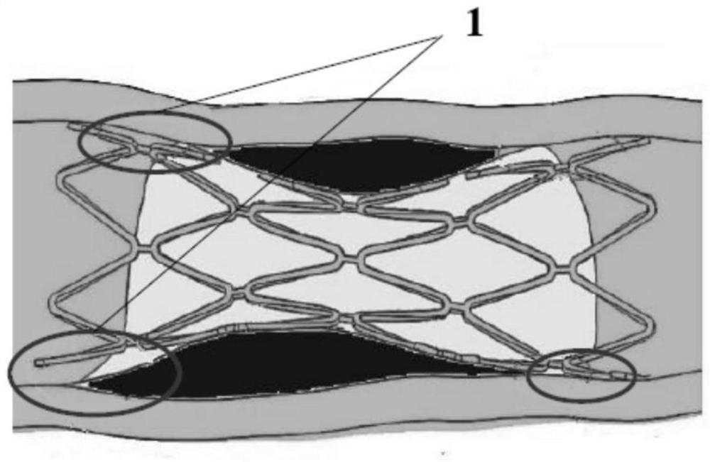 A kind of conformal adherent intravascular stent