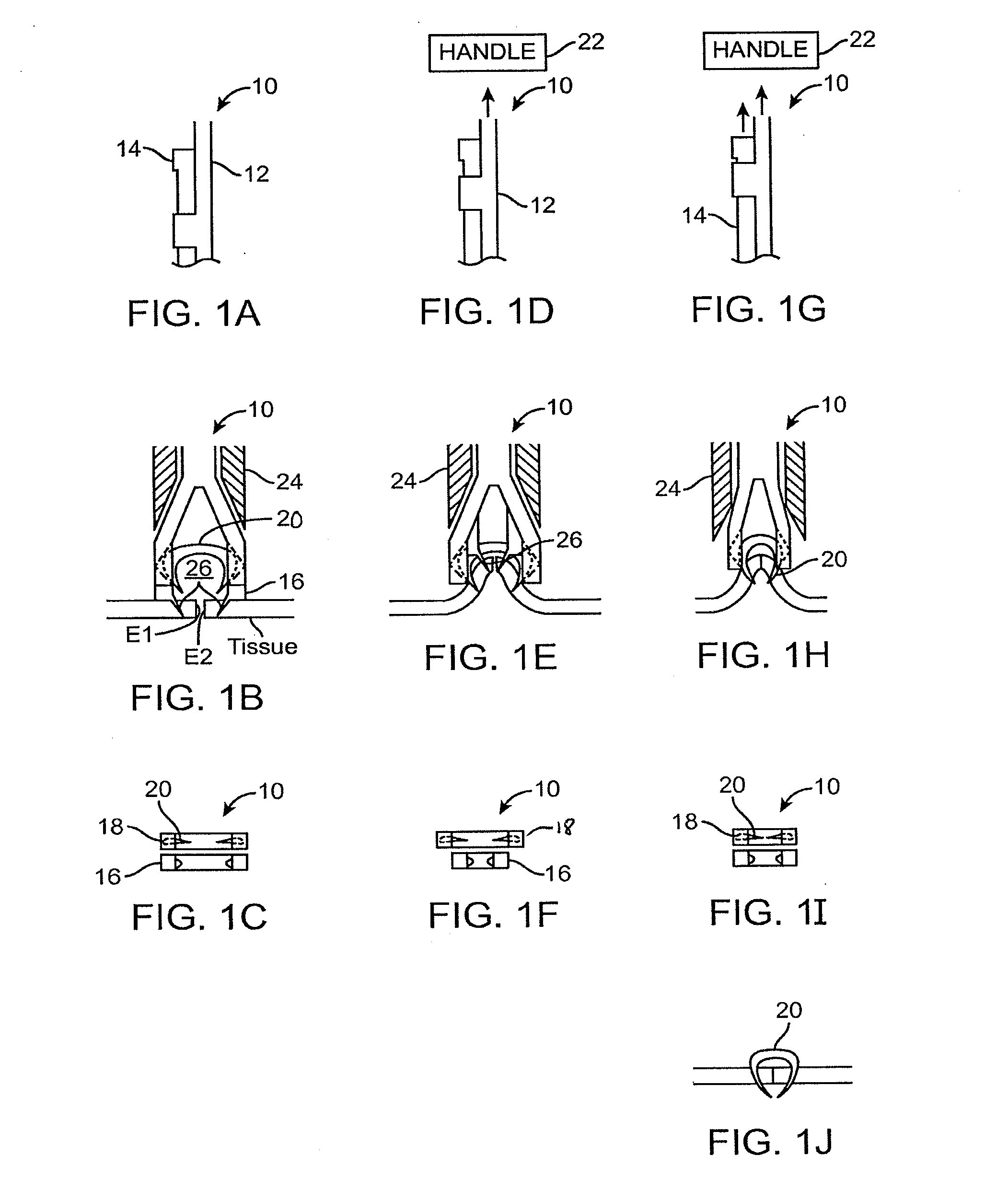Fasteners, Deployment Systems, and Methods for Ophthalmic Tissue Closure and Fixation of Ophthalmic Prostheses and Other Uses