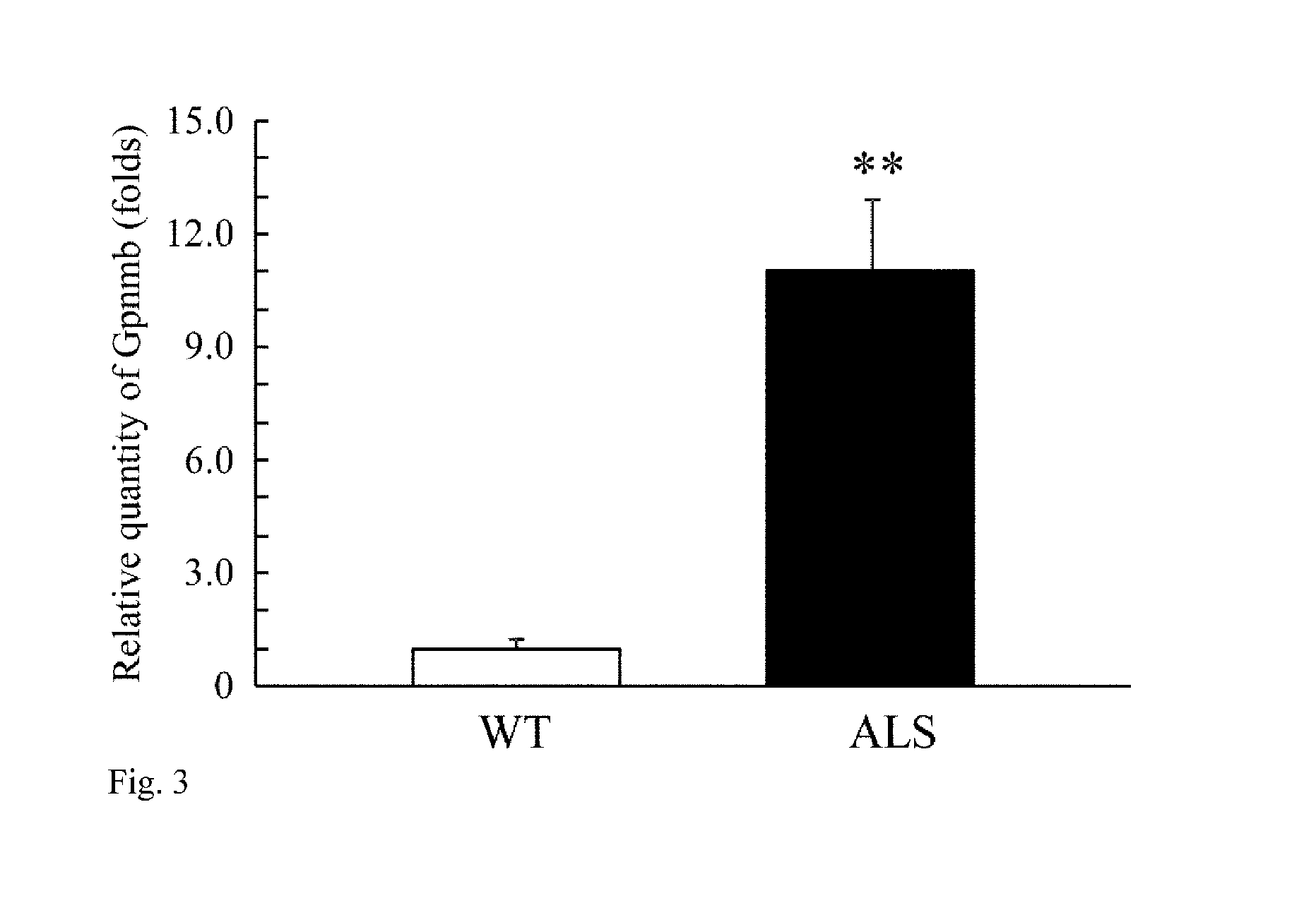 Marker for amyotrophic lateral sclerosis, and use thereof