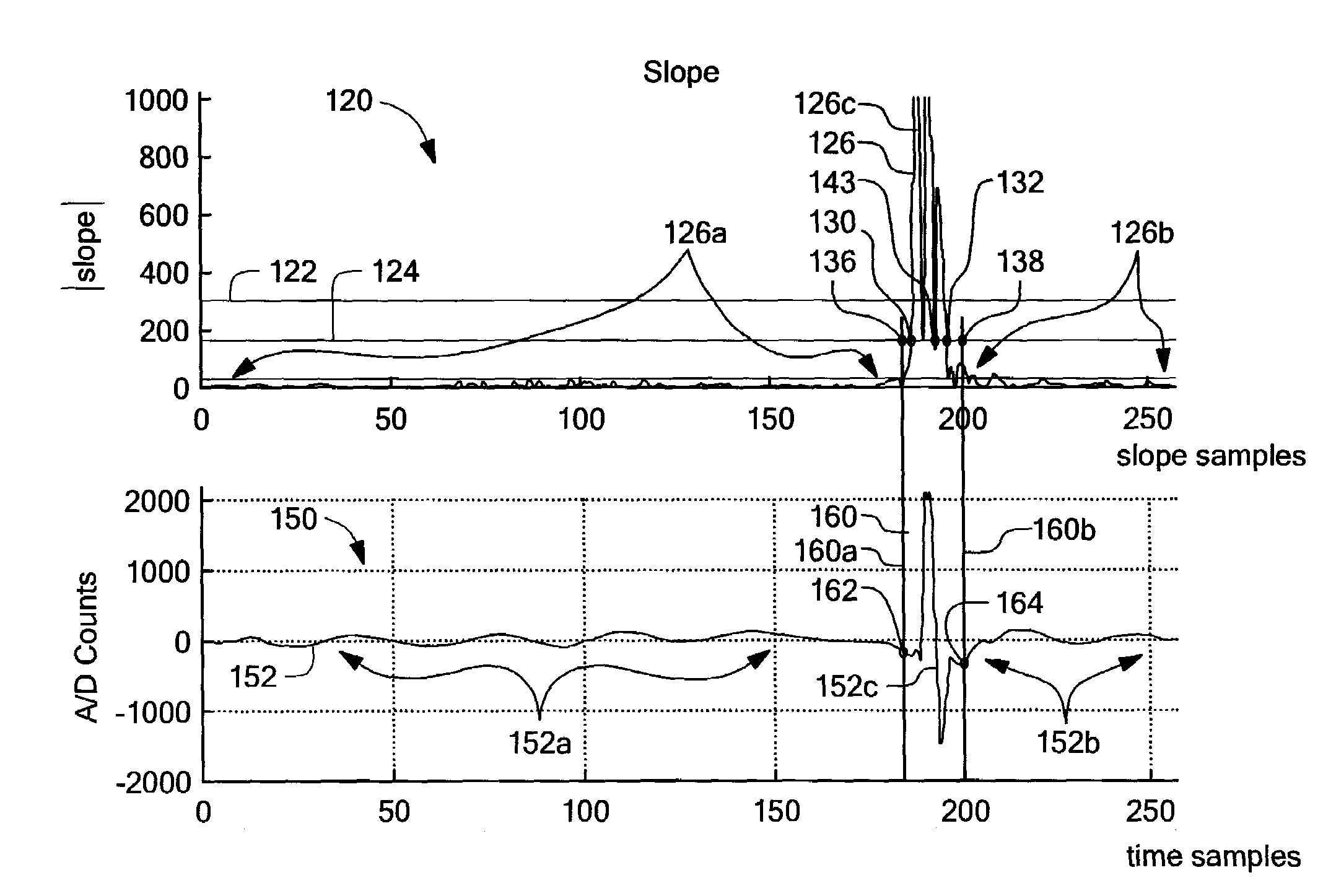 System and method for reducing the effect of a radar interference signal