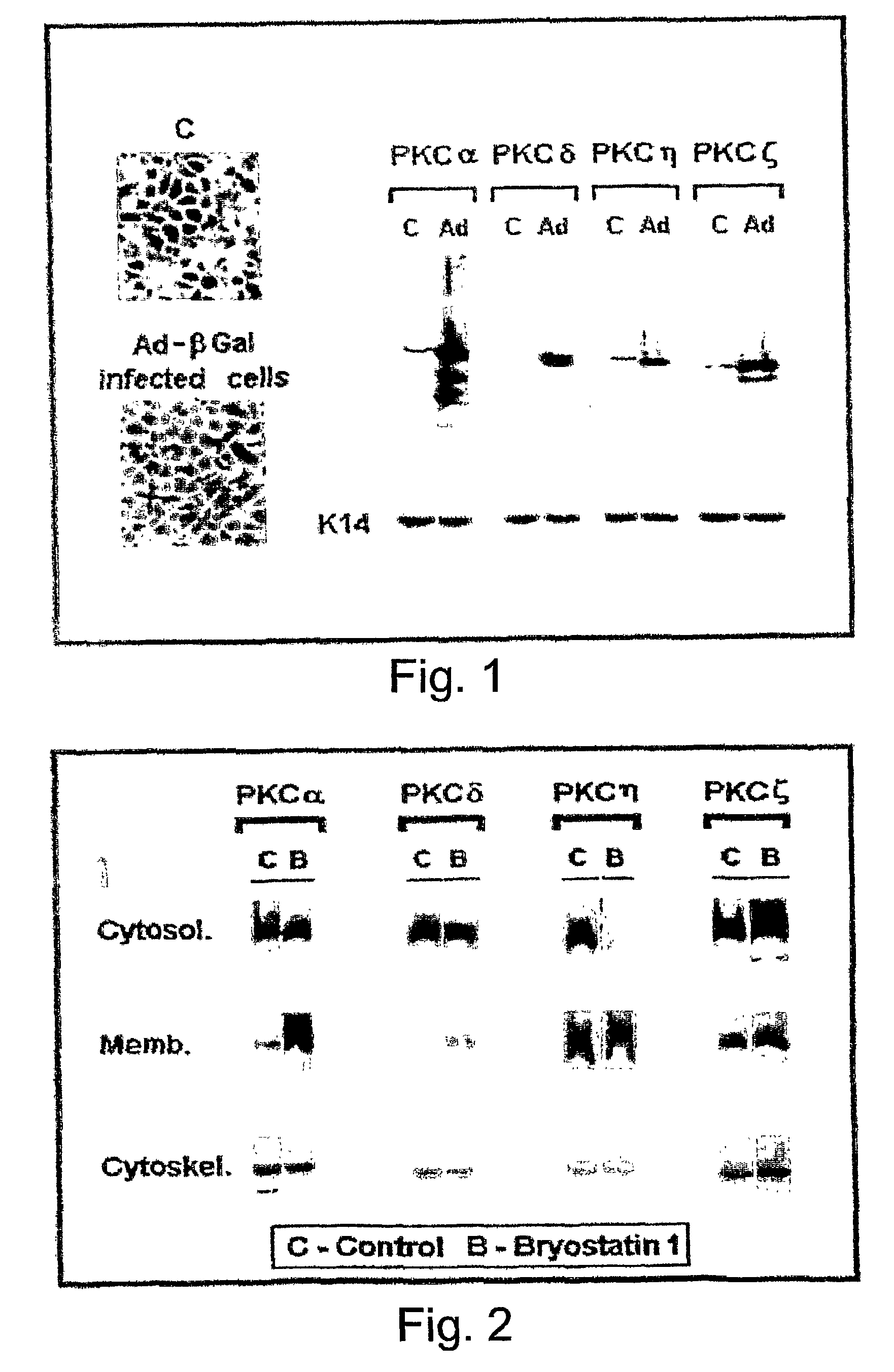 Methods and pharmaceutical compositions for healing wounds