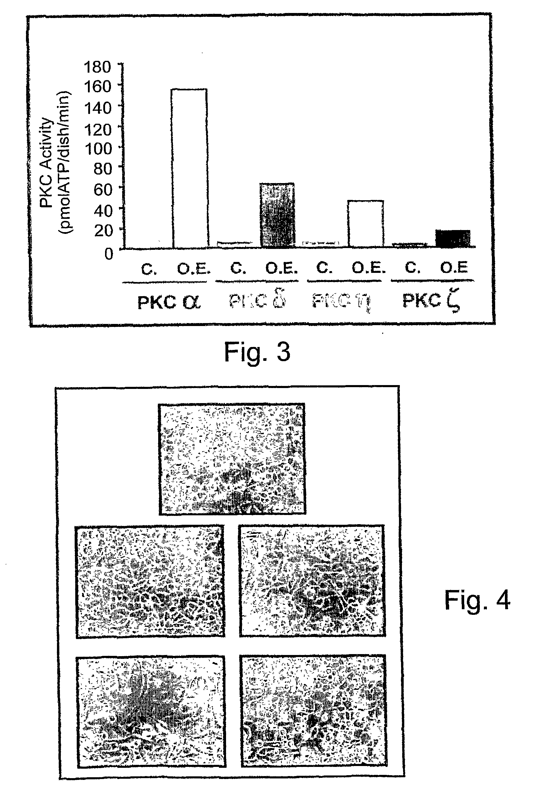 Methods and pharmaceutical compositions for healing wounds