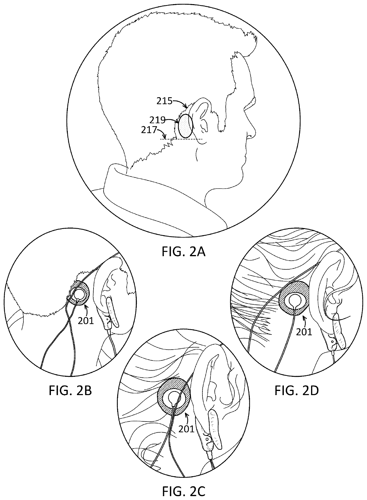 Apparatuses and methods for transdermal electrical stimulation of nerves to modify or induce a cognitive state