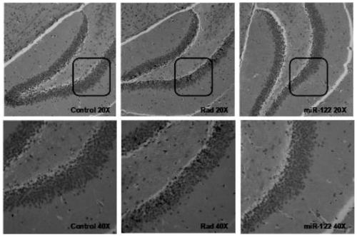 Application of miR-122 and inhibitor thereof to prevention/treatment of radiation-induced brain injury