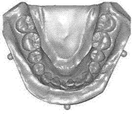 Tooth preparation-based data flexible fusion method