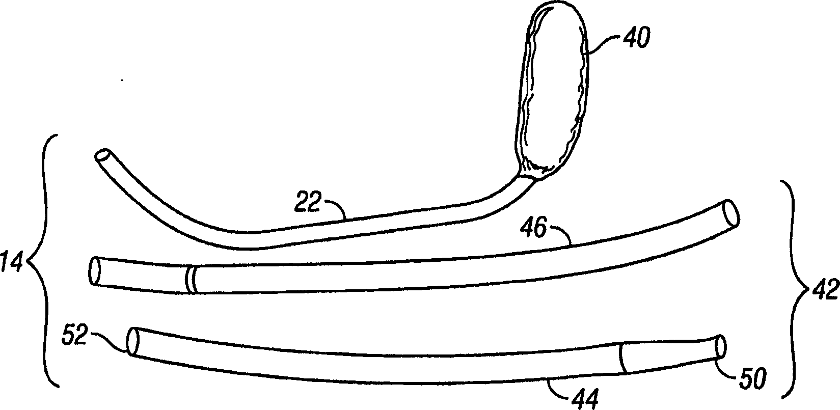 Endoscopic wound care treatment system and method