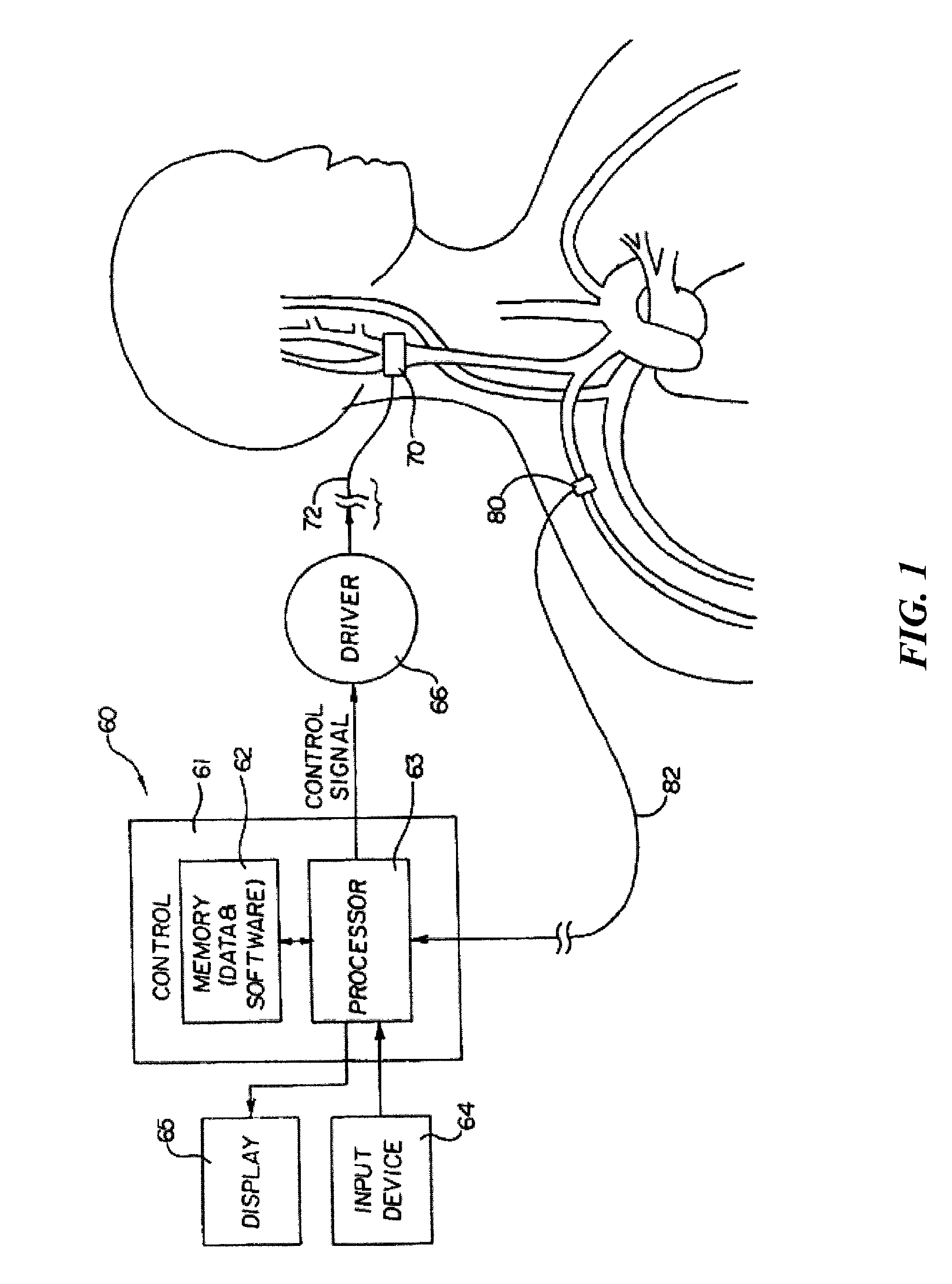 Elective service indicator based on pulse count for implantable device