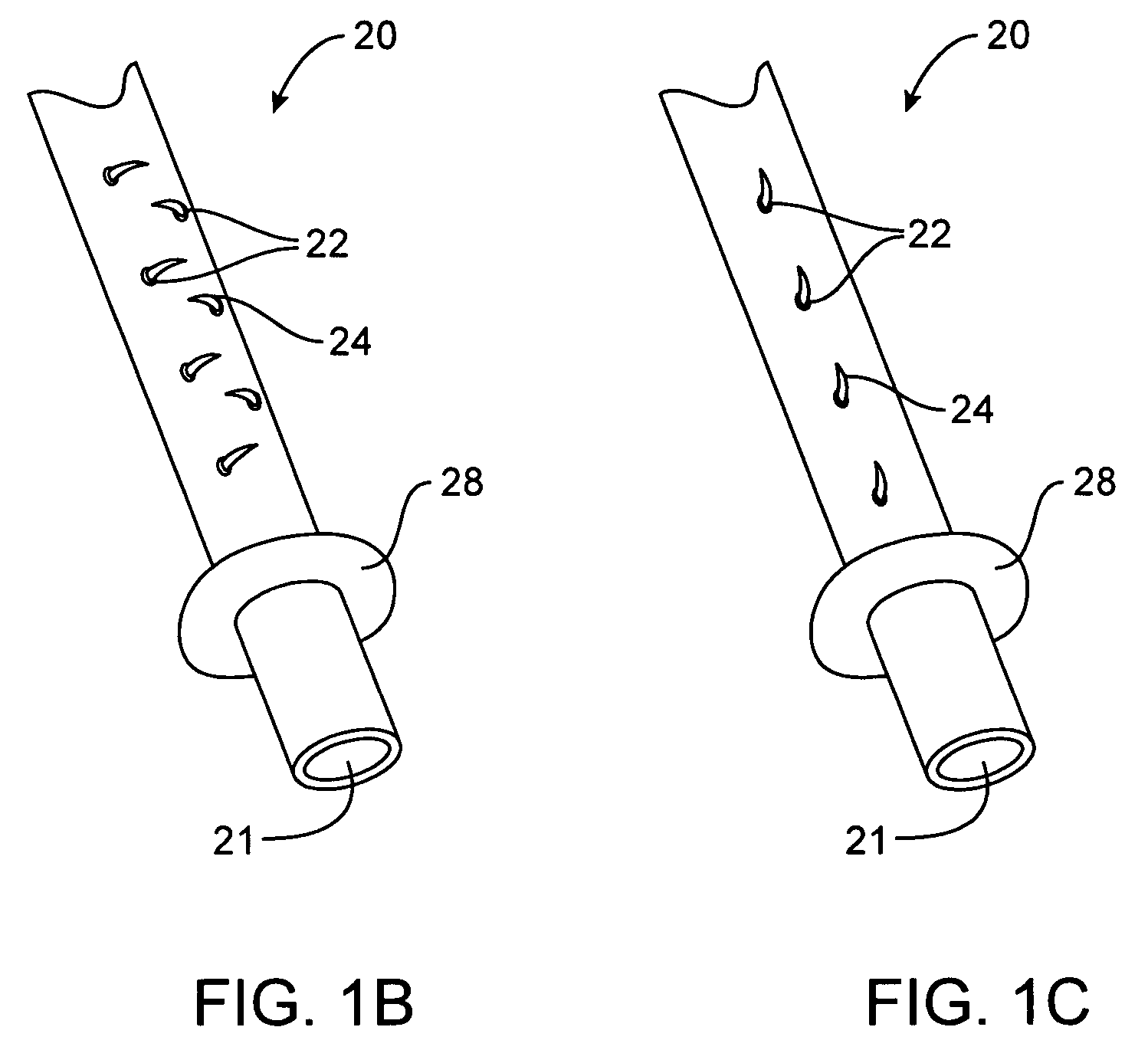 Methods and apparatus for performing endoluminal gastroplasty