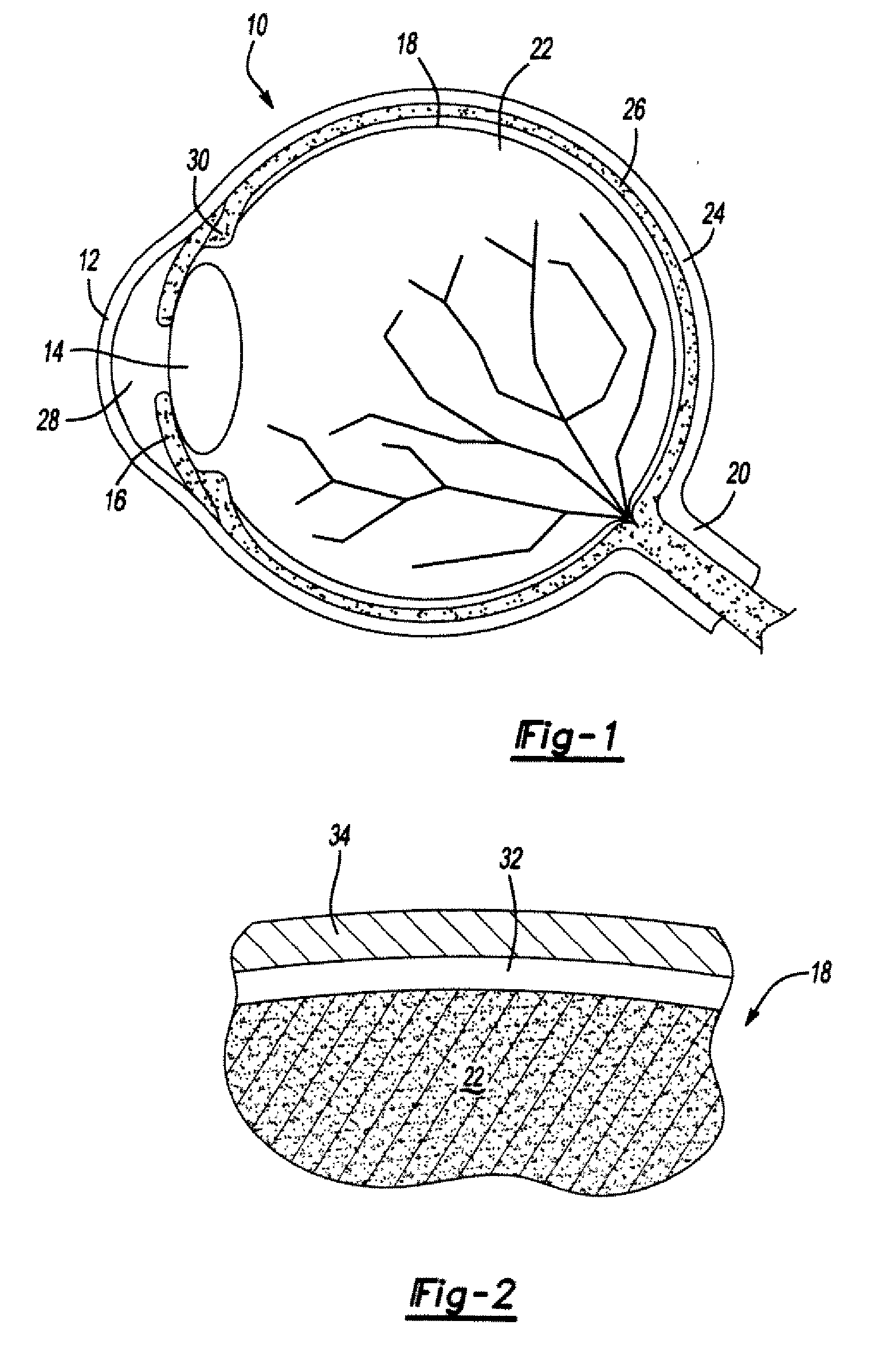 Ophthalmological surgery colorant and delivery system