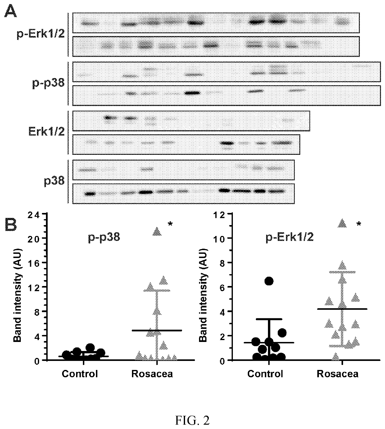 Treatment of rosacea with P38 and Erk kinase pathway inhibitors